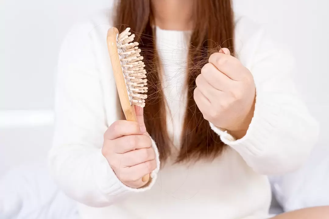Perdita di capelli e trattamento con un verdexil spray